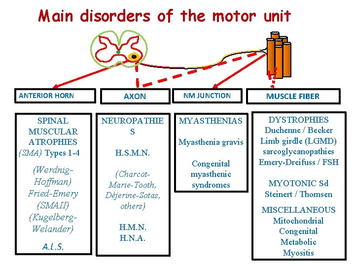 Main disorders of the motor unit ANTERIOR HORN SPINAL MUSCULAR ATROPHIES (SMA) Types 1