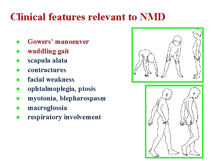 Clinical features relevant to NMD · · · · · Gowers’ manoeuver waddling gait