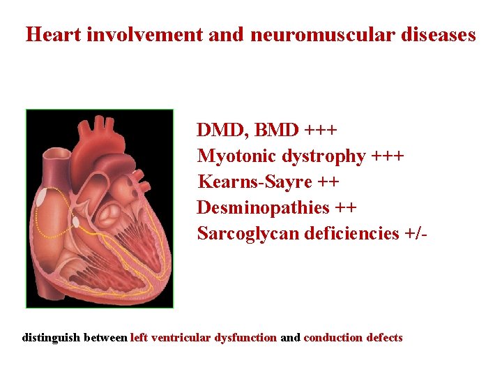 Heart involvement and neuromuscular diseases DMD, BMD +++ Myotonic dystrophy +++ Kearns-Sayre ++ Desminopathies