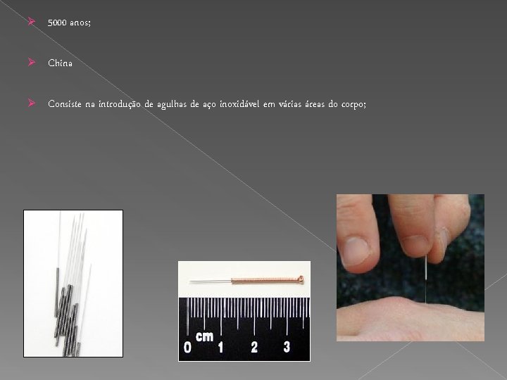 Ø 5000 anos; Ø China Ø Consiste na introdução de agulhas de aço inoxidável