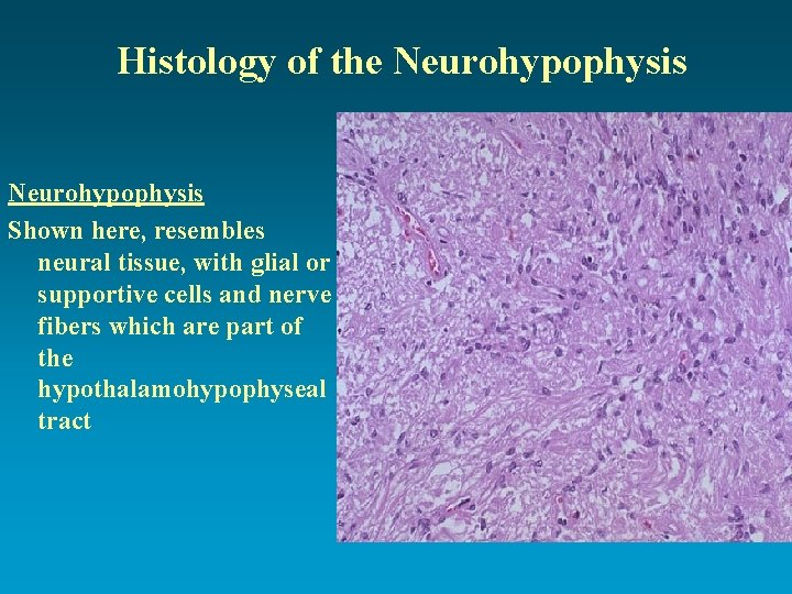 Histology of the Neurohypophysis Shown here, resembles neural tissue, with glial or supportive cells