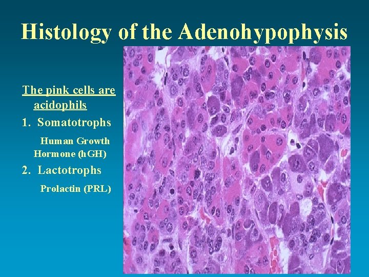 Histology of the Adenohypophysis The pink cells are acidophils 1. Somatotrophs Human Growth Hormone