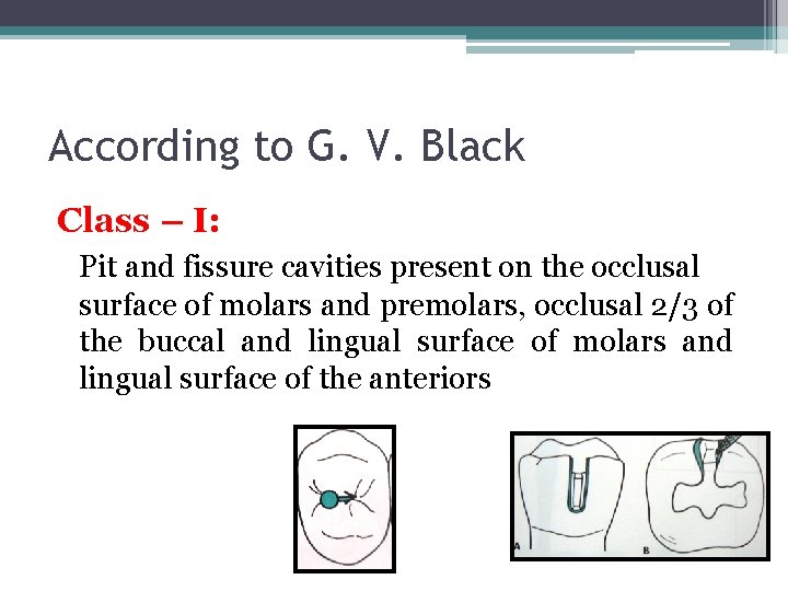 According to G. V. Black Class – I: Pit and fissure cavities present on