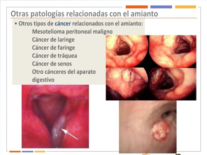 peritoneal mesothelioma cap protocol