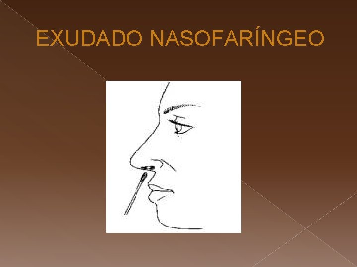 EXUDADO NASOFARÍNGEO 