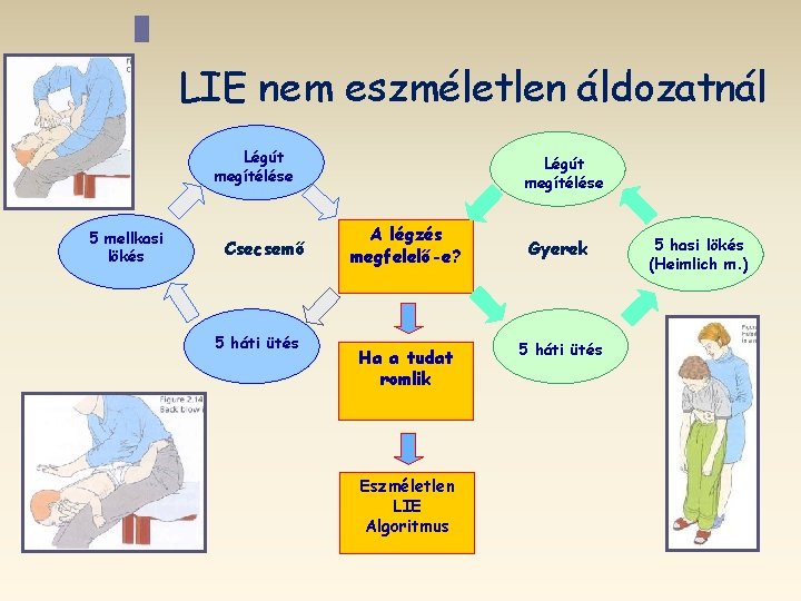 LIE nem eszméletlen áldozatnál Légút megítélése 5 mellkasi lökés Csecsemő 5 háti ütés Légút