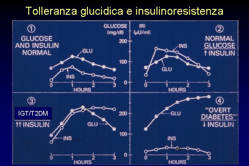 Tolleranza glucidica e insulinoresistenza IGT/T 2 DM 