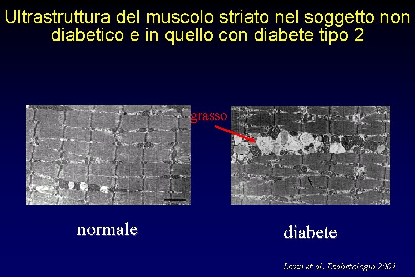 Ultrastruttura del muscolo striato nel soggetto non diabetico e in quello con diabete tipo