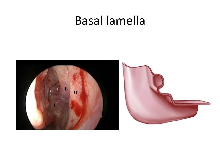 Basal lamella B L U Basal lamella B L U