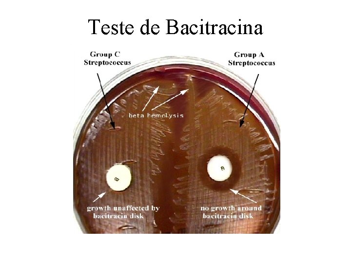 Teste de Bacitracina 