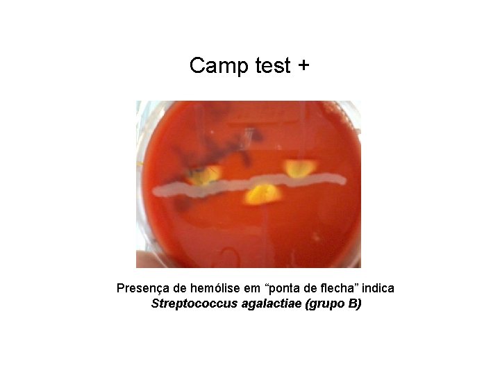 Camp test + Presença de hemólise em “ponta de flecha” indica Streptococcus agalactiae (grupo