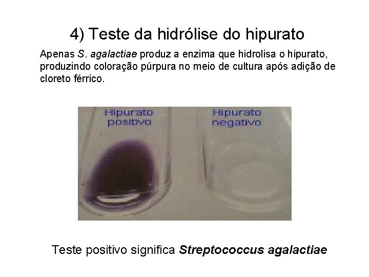 4) Teste da hidrólise do hipurato Apenas S. agalactiae produz a enzima que hidrolisa