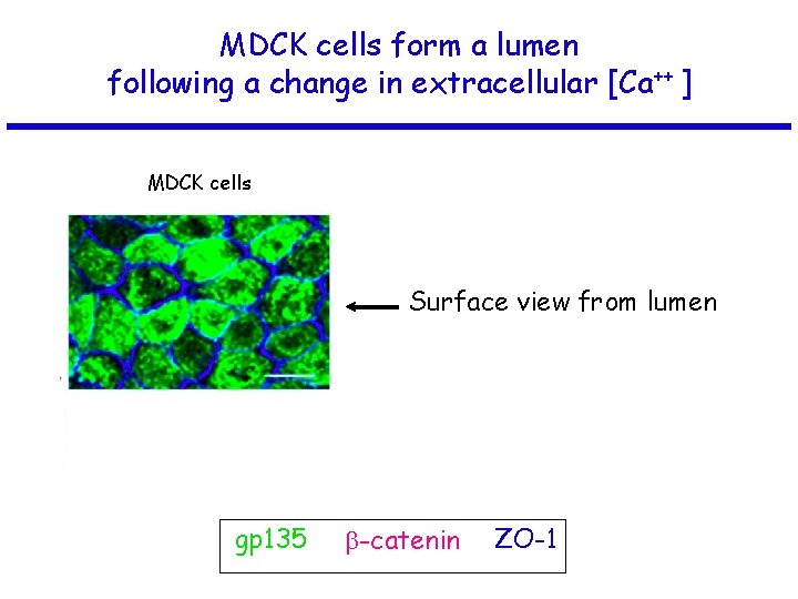 MDCK cells form a lumen following a change in extracellular [Ca++ ] MDCK cells
