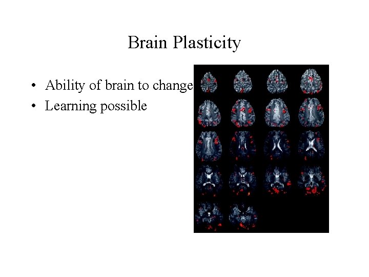 Brain Plasticity • Ability of brain to change • Learning possible 