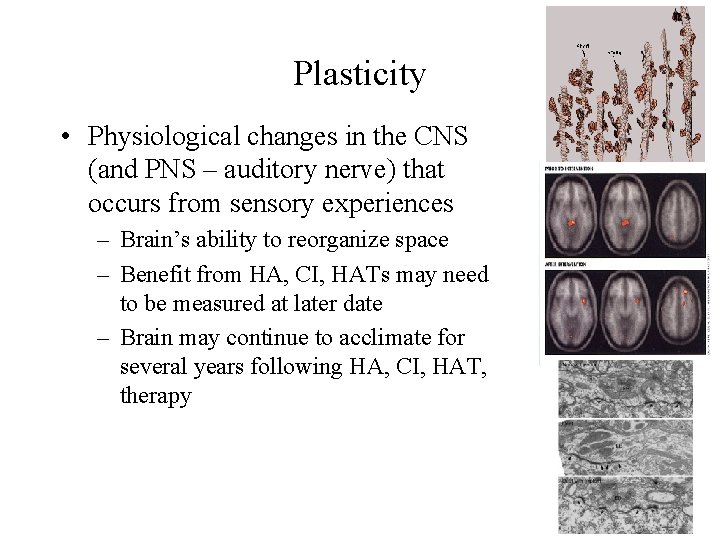Plasticity • Physiological changes in the CNS (and PNS – auditory nerve) that occurs