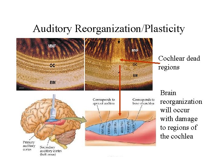 Auditory Reorganization/Plasticity Cochlear dead regions Brain reorganization will occur with damage to regions of