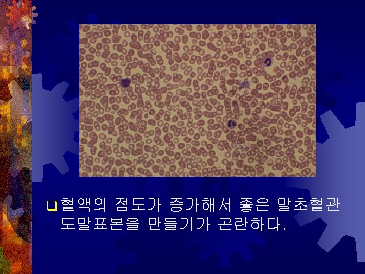 View of Polycythemia Vera in a Dog Case 19 History