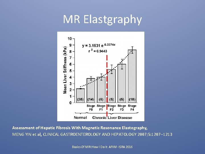 MR Elastgraphy Assessment of Hepatic Fibrosis With Magnetic Resonance Elastography, MENG YIN et al,