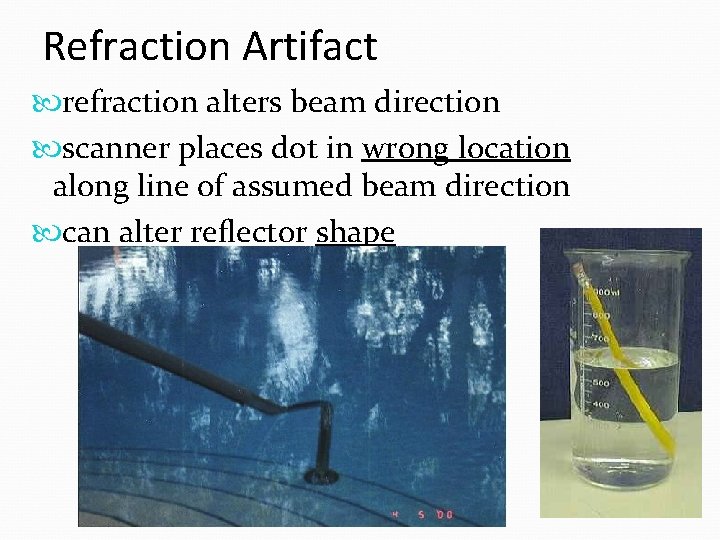 Refraction Artifact refraction alters beam direction scanner places dot in wrong location along line