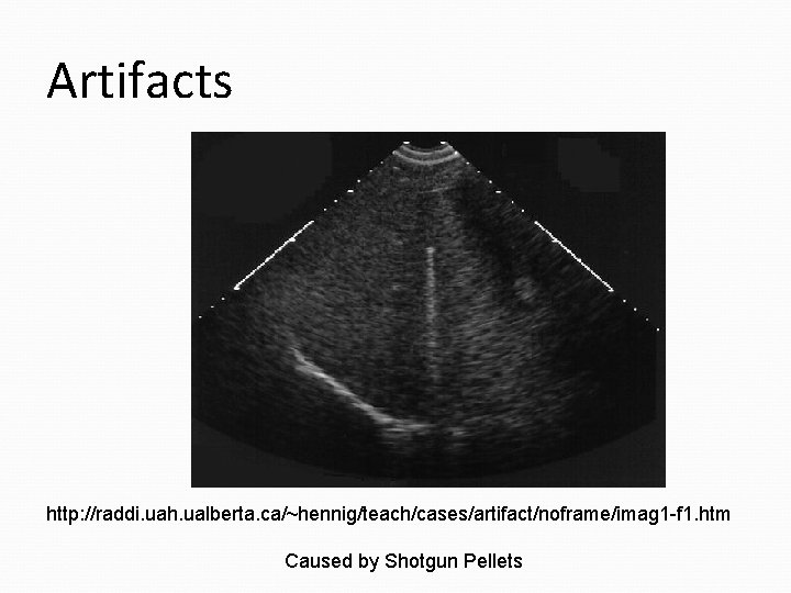 Artifacts http: //raddi. uah. ualberta. ca/~hennig/teach/cases/artifact/noframe/imag 1 -f 1. htm Caused by Shotgun Pellets