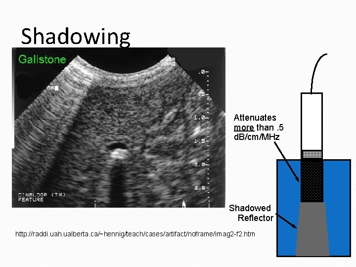 Shadowing Attenuates more than. 5 d. B/cm/MHz Shadowed Reflector http: //raddi. uah. ualberta. ca/~hennig/teach/cases/artifact/noframe/imag Shadowing Attenuates more than. 5 d. B/cm/MHz Shadowed Reflector http: //raddi. uah. ualberta. ca/~hennig/teach/cases/artifact/noframe/imag