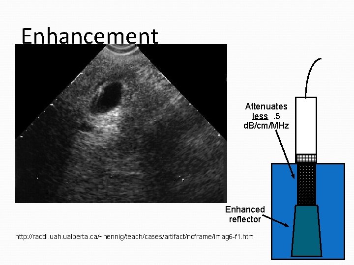 Enhancement Attenuates less. 5 d. B/cm/MHz Enhanced reflector http: //raddi. uah. ualberta. ca/~hennig/teach/cases/artifact/noframe/imag 6