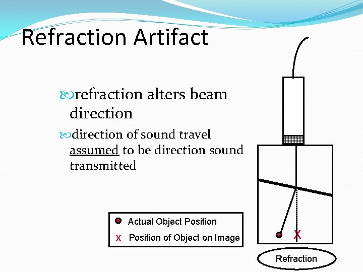 Refraction Artifact refraction alters beam direction of sound travel assumed to be direction sound