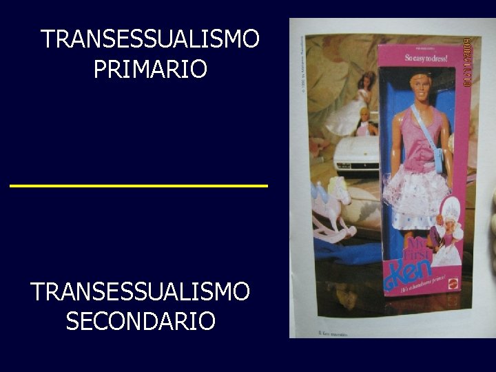 TRANSESSUALISMO PRIMARIO TRANSESSUALISMO SECONDARIO 