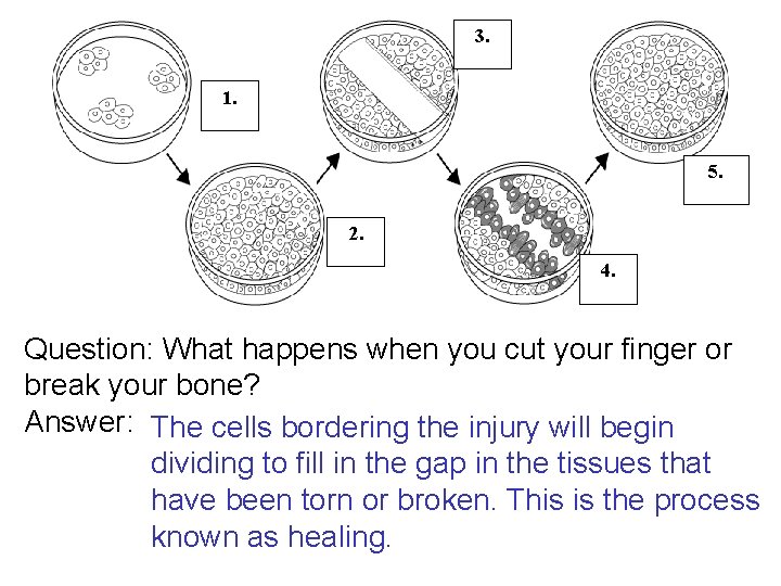 3. 1. 5. 2. 4. Question: What happens when you cut your finger or