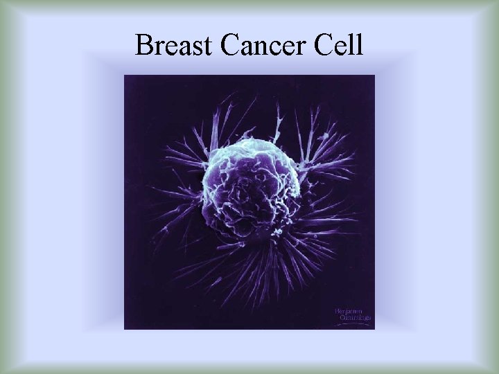 Breast Cancer Cell 