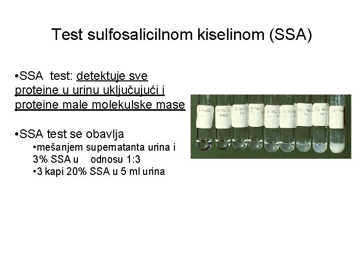 Test sulfosalicilnom kiselinom (SSA) • SSA test: detektuje sve proteine u urinu uključujući i