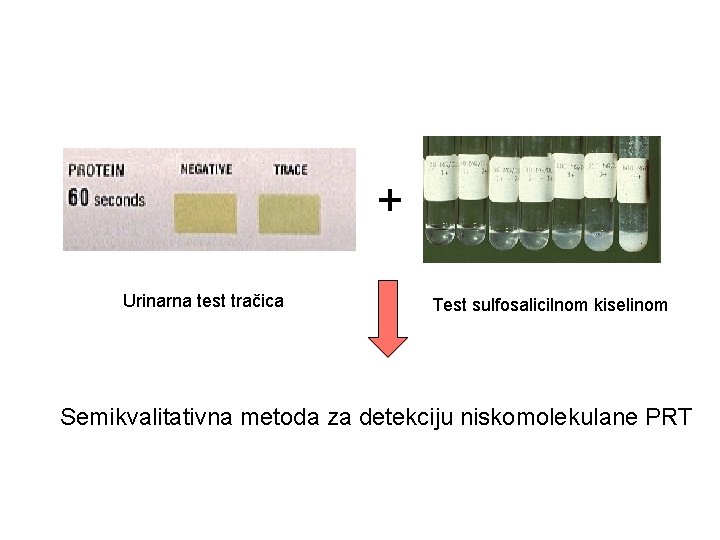 + Urinarna test tračica Test sulfosalicilnom kiselinom Semikvalitativna metoda za detekciju niskomolekulane PRT 