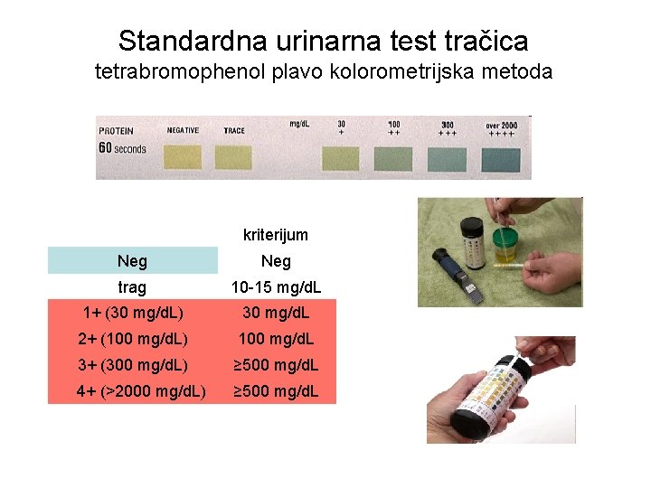 Standardna urinarna test tračica tetrabromophenol plavo kolorometrijska metoda kriterijum Neg trag 10 -15 mg/d.