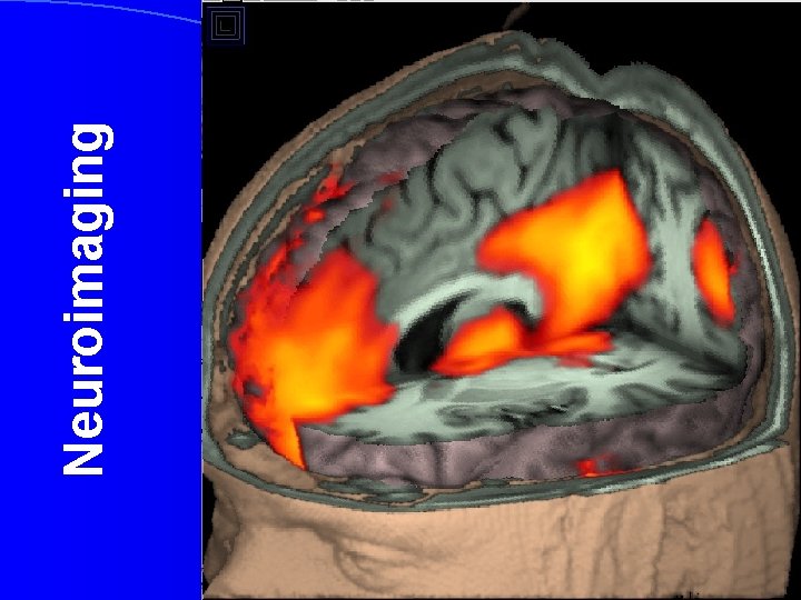 Neuroimaging 