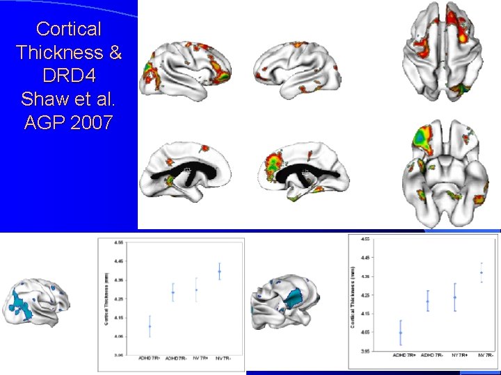 Cortical Thickness & DRD 4 Shaw et al. AGP 2007 