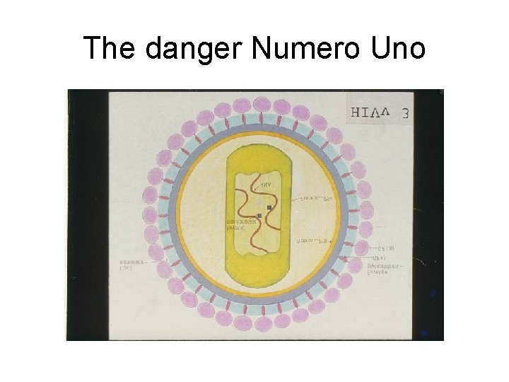 The danger Numero Uno 