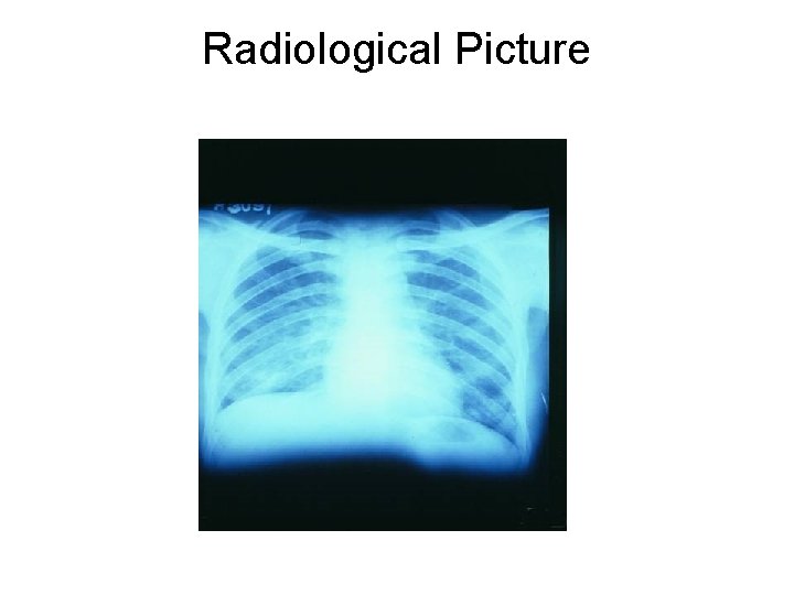 Radiological Picture 