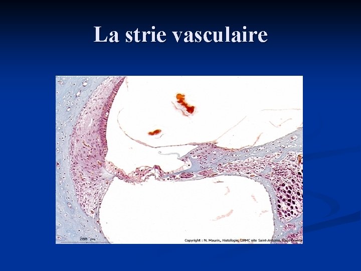 La strie vasculaire 