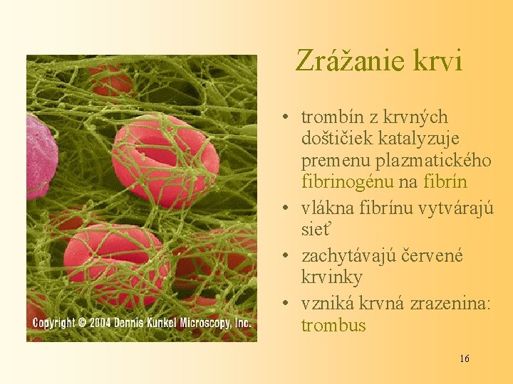 Zrážanie krvi • trombín z krvných doštičiek katalyzuje premenu plazmatického fibrinogénu na fibrín •