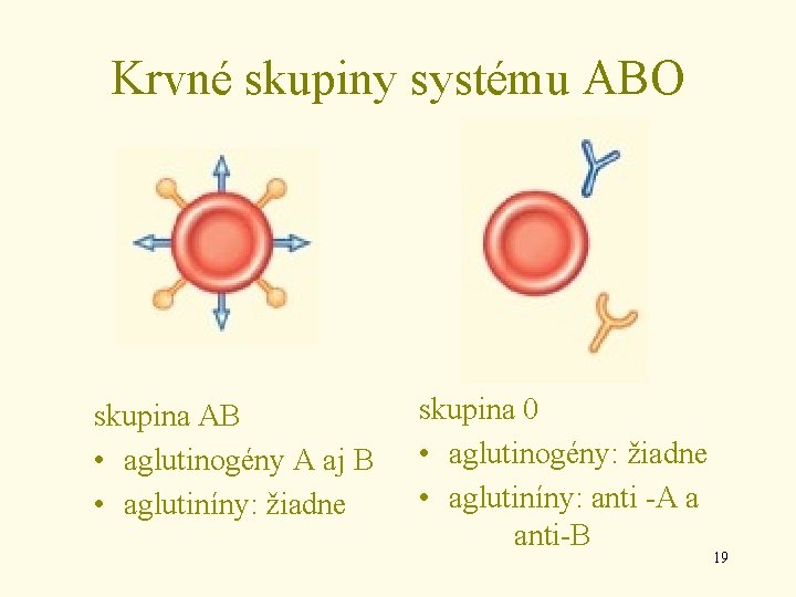 Krvné skupiny systému ABO skupina AB • aglutinogény A aj B • aglutiníny: žiadne