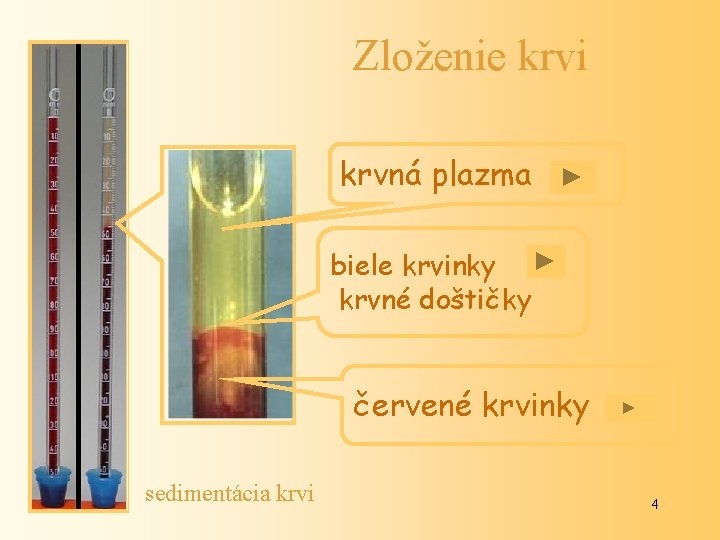 Zloženie krvi krvná plazma biele krvinky krvné doštičky červené krvinky sedimentácia krvi 4 