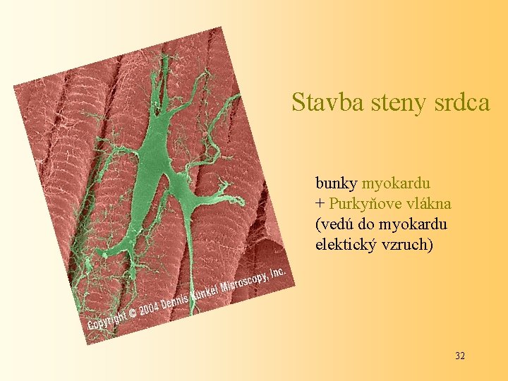 Stavba steny srdca bunky myokardu + Purkyňove vlákna (vedú do myokardu elektický vzruch) 32