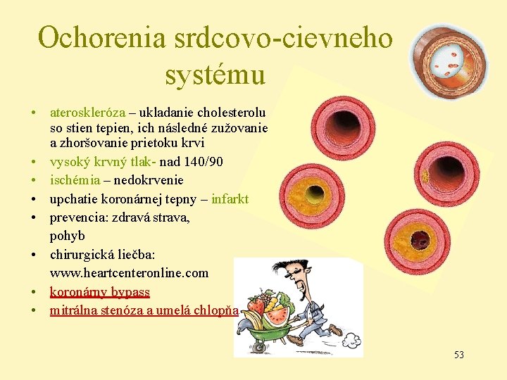 Ochorenia srdcovo-cievneho systému • ateroskleróza – ukladanie cholesterolu so stien tepien, ich následné zužovanie