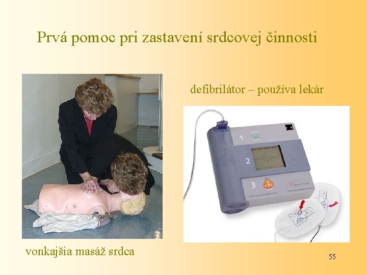 Prvá pomoc pri zastavení srdcovej činnosti defibrilátor – používa lekár vonkajšia masáž srdca 55