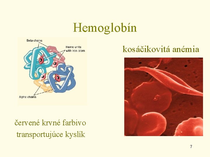 Hemoglobín kosáčikovitá anémia červené krvné farbivo transportujúce kyslík 7 
