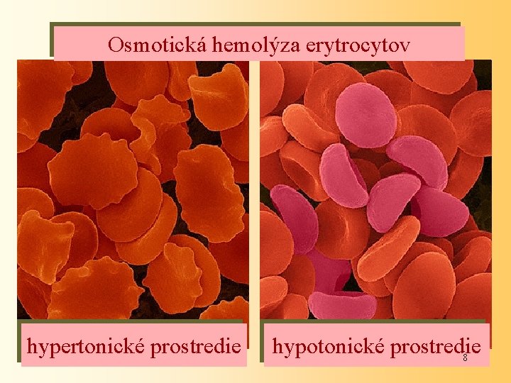 Osmotická hemolýza erytrocytov hypertonické prostredie hypotonické prostredie 8 