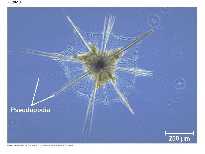 Fig. 28 -18 Pseudopodia 200 µm 