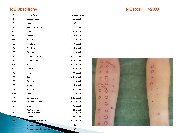 lg. E Specifiche Ig. E totali Test Nome Test Concentrazione f 1 Bianco d'uovo