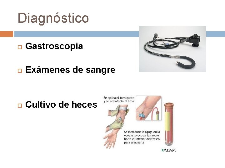 Diagnóstico Gastroscopia Exámenes de sangre Cultivo de heces 