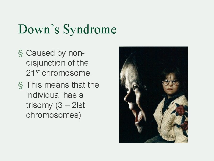 Down’s Syndrome § Caused by nondisjunction of the 21 st chromosome. § This means